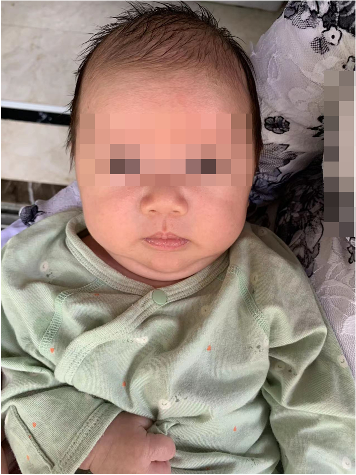 新生儿医保卡照片回执怎么弄？